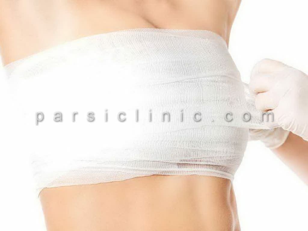 جراحی ماموپلاستی و لیفت سینه