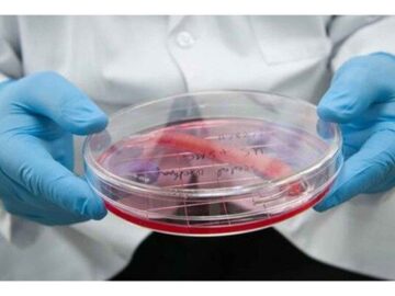 دست انداز تاخیر در ارائه مجوز در مسیر توسعه صنعت پزشکی| سلول درمانی کلید درمان بیماری های لاعلاج