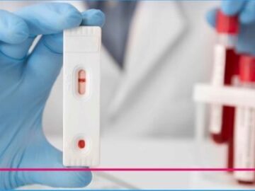 آزمایش هورمونی بانوان شامل چه مواردی است؟